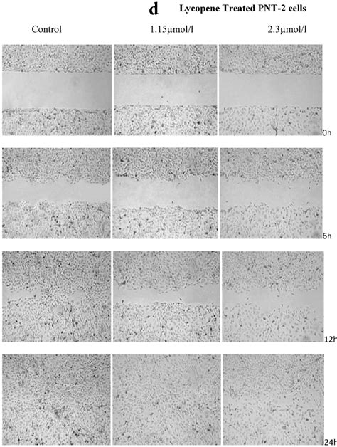 Effect Of Lycopene On Migratory Properties Of Prostate Cells Migration