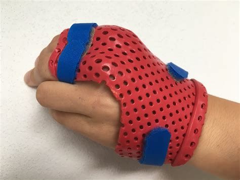 Sports Injuries - Health on High