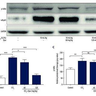 Histological Analysis Of Liver Injury Induced By Carbon Tetrachloride