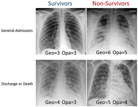 Diagnostics Free Full Text Longitudinal Chest X Ray Scores And