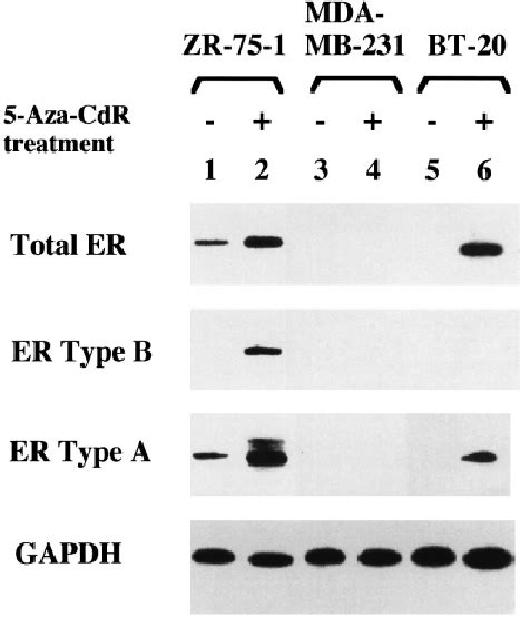 Effects Of 5 Aza Dc On Er α Gene Expression In Human Breast Cancer Cell Download Scientific