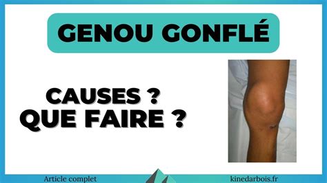 Genou Gonfl Et Chaud Pourquoi Que Faire Conseils Kin