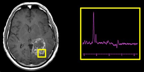 Magnetism Questions And Answers In MRI