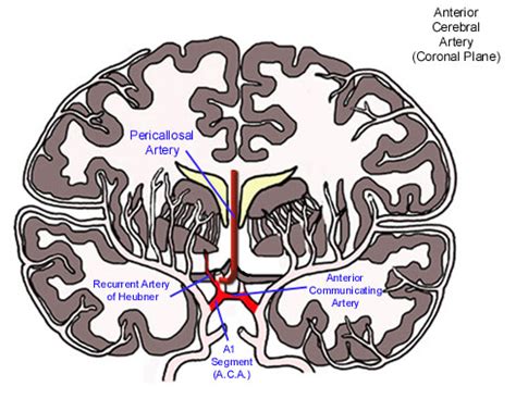 Anterior Cerebral Artery Stroke