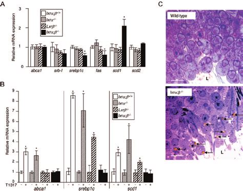 Analysis Of The Lipid Metabolism In Testes Of Wild Type And