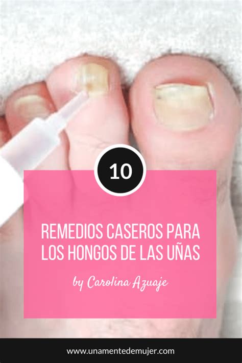 10 Tratamientos Caseros Para Hongos En Las Uñas