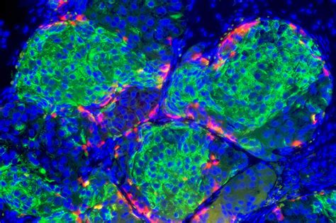 Stem Cell Science Taking Aim At Type 1 Diabetes Nih Directors Blog