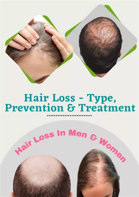 Ppt Hair Loss Type Cause Prevention And Treatment Powerpoint