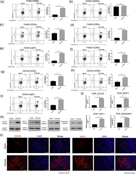 MiR 155 5p SOCS1 JAK1 STAT1 Participates In Hepatic Lymphangiogenesis