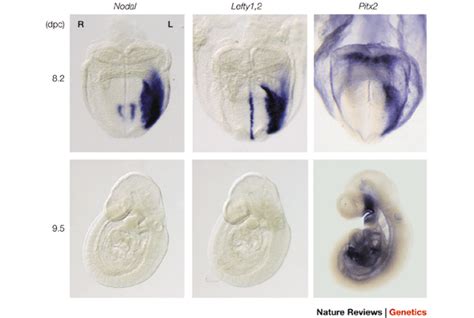 Establishment Of Vertebrate Leftright Asymmetry Nature Reviews Genetics