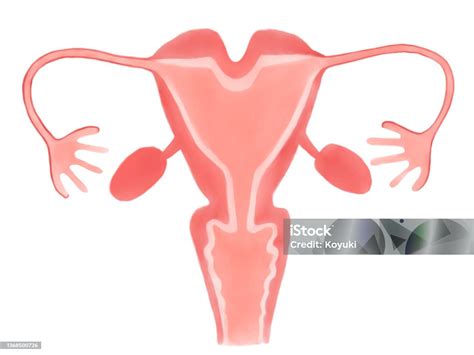 Congenital Anomalies Of The Uterus Class U3 Bicorporeal Uterus Stock