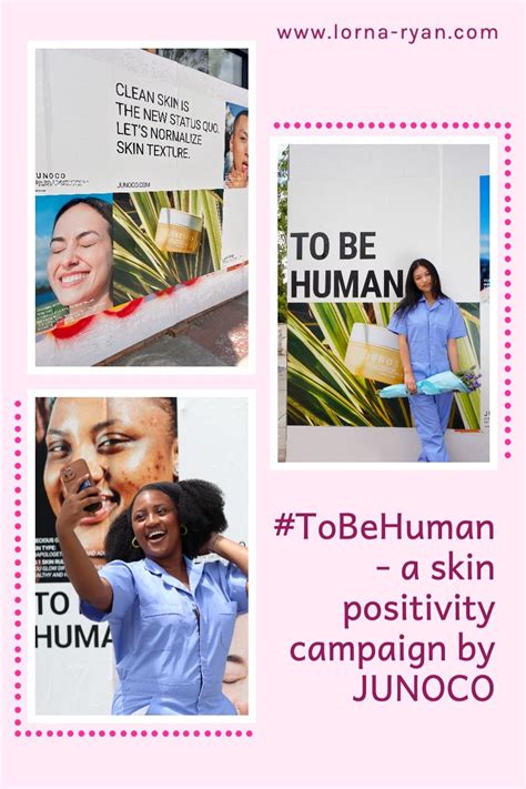 Junoco Tobehuman Skin Positivity Campaign What The Beauty Industry