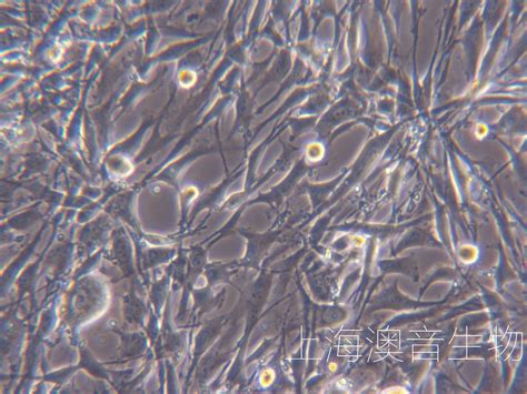 U 138mg人脑星形胶质母细胞瘤 企业官网