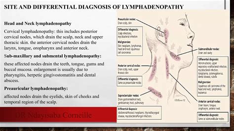 Lymphadenopathy Ppt