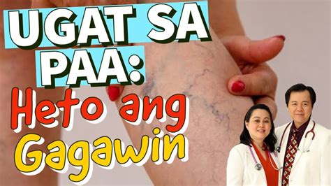 Ugat Sa Paa Heto Ang Gagawin Payo Ni Doc Liza Ramoso Ong Youtube