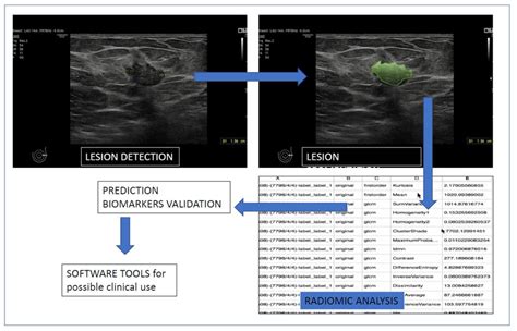 Diagnostics Free Full Text Artificial Intelligence In Breast Ultrasound From Diagnosis To