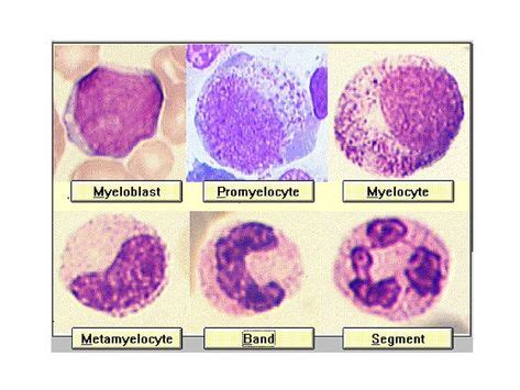 10+ Hematology Slides ideas in 2020 | hematology, medical lab ...