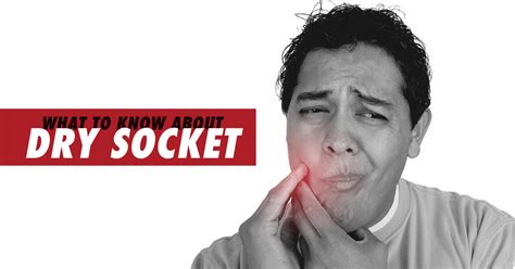 What You Need To Know About Dry Socket Lynnfield Dental Associates Blog