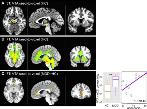 Functional Connectivity Of The Ventral Tegmental Area Vta With Download Scientific Diagram