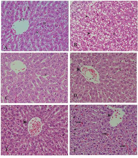 Aphotomicrograph Of Section Of Liver From Control Rats Showing Normal