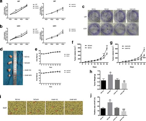 Smarcd1 Inhibited Glioblastoma Cell Growth Both In Vivo And In Vitro