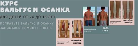 Вальгус и осанка ребенка. ЛФК | Исправлю осанку, стопы, походку ребенка ...