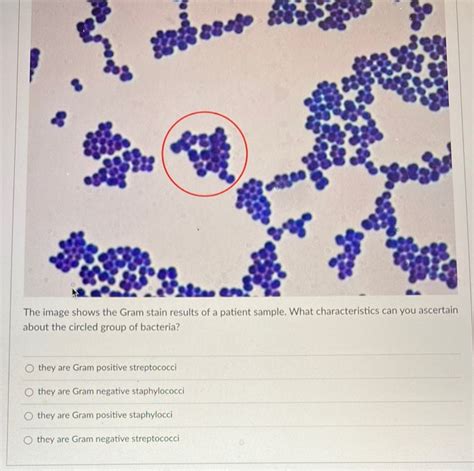 Gram Negative Streptococci