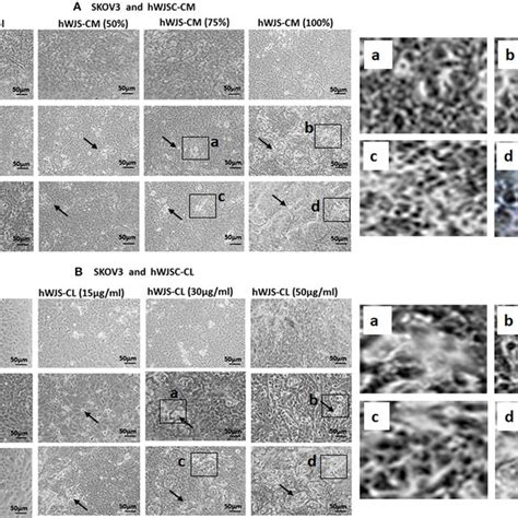 Representative Phase Contrast Images Of SKOV3 Cells Treated With