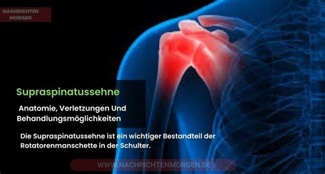 Supraspinatussehne Anatomie Verletzungen Und Behandlungsm Glichkeiten