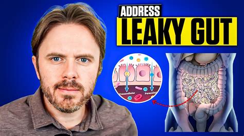 Understanding Leaky Gut Symptoms And Solutions With Dr Justin