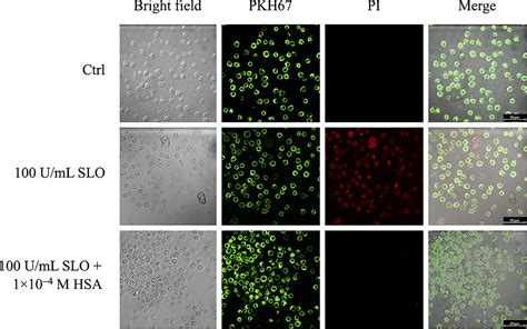 Frontiers Human Serum Albumin Binds Streptolysin O SLO Toxin