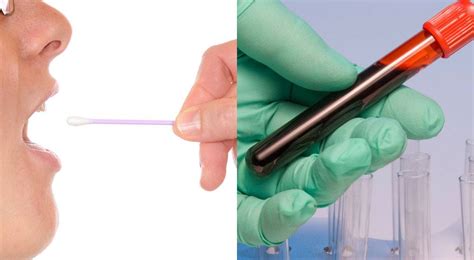 DNA Testing: Swabs vs. Blood Samples - DNA Diagnostics Centre