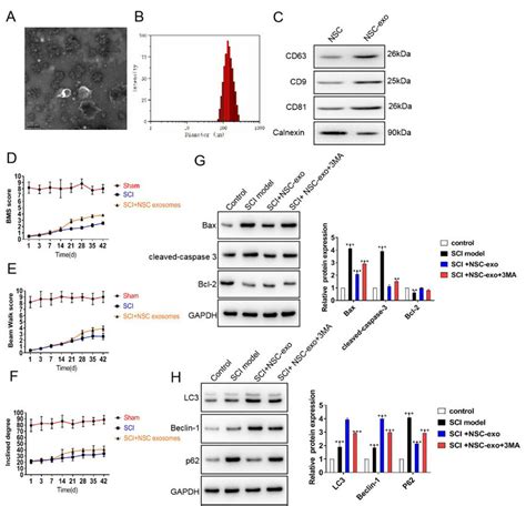 Neural Stem Cell Nsc Derived Exosome Could Protect Against Spinal