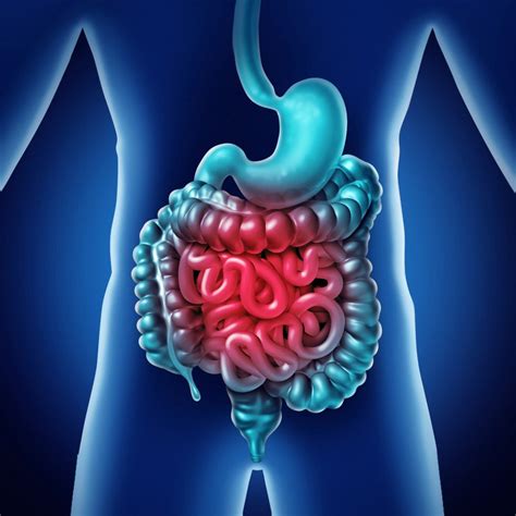 Síndrome del colon irritable síntomas tratamiento y diagnóstico