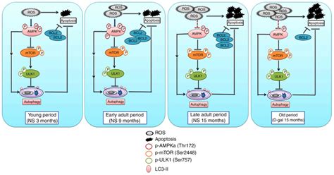 Autophagy Regulates The Degeneration Of The Auditory Cortex Through The