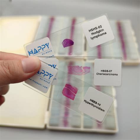 High Resolution Scan Copies Of Pathology Slides Digital Pathology Slides