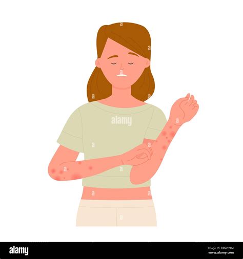 Girl Scratching Hands Covered With Red Rash Skin Allergic Reaction Atopic Dermatitis Vector