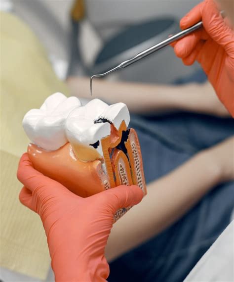 Wisdom Tooth Extraction Causes Procedure And Recovery