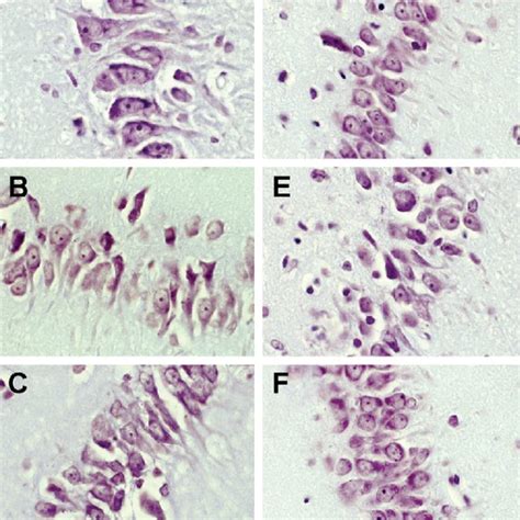 Photomicrographs Of The Hippocampus CA1 Field Stained With Cresyl