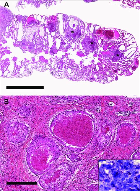 Microscopic Examination Of Granulomatous Lesions In Organs Of Female 1