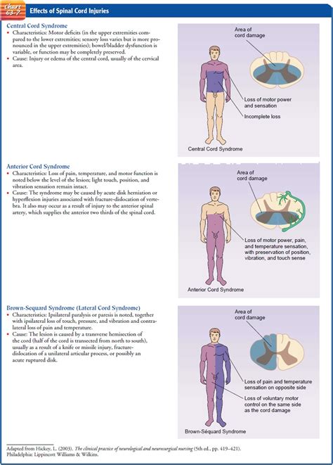 Nursing Process The Patient With Acute Spinal Cord Injury