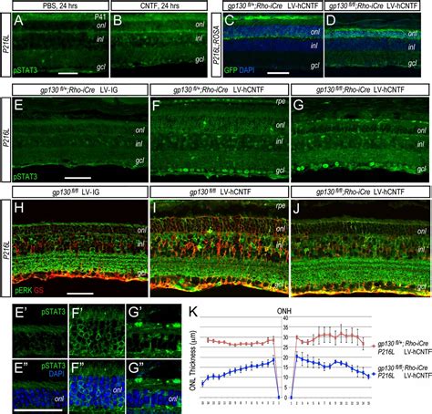 Cntf Mediated Protection Of Photoreceptors Requires Initial Activation