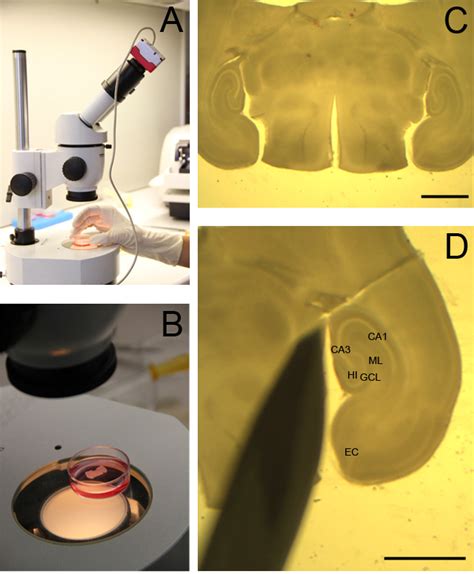 Organotypic Hippocampal Slice Cultures As A Model To Study