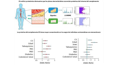 Identifican Un Biomarcador Que Detecta La Existencia De Aterosclerosis Antes De Tener Síntomas