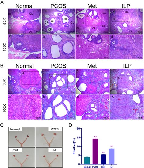 Morphological Effects Of Ovary And Uterus And Ovarian Fibrosis A