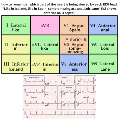 Easy Memory Trick To Remember Which View Of The Heart Is Shown By Each