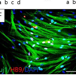 Schematic Of Differentiation Of Tonsil Derived Mesenchymal Stem Cells