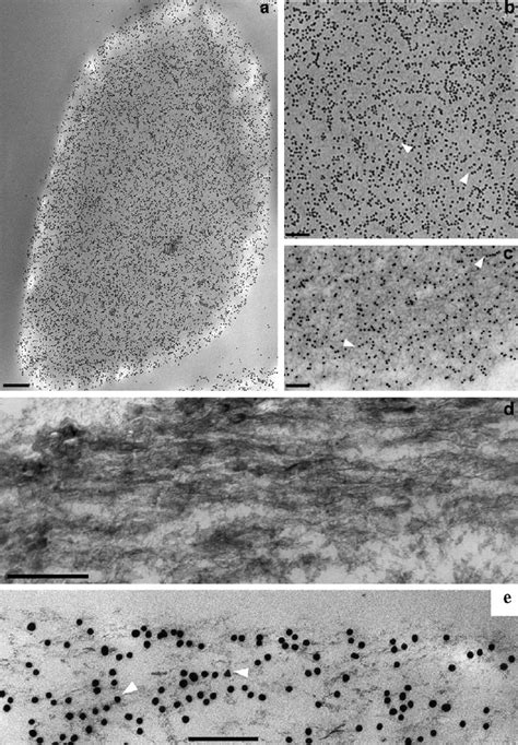 Immunogold Tem Of Oc In Outer Cortex A Low Magni Fi Cation View Of