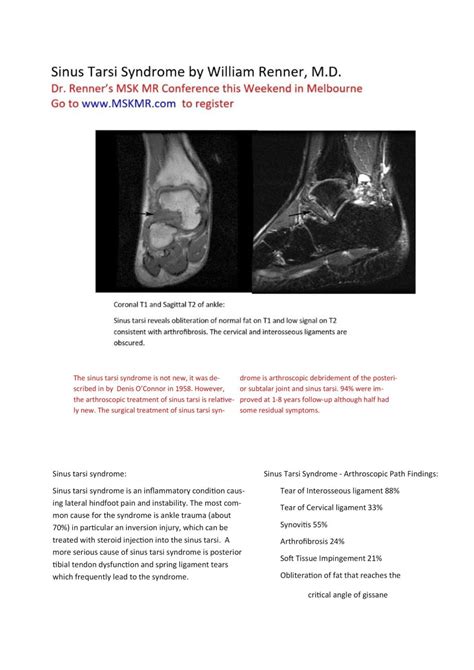 Sinus Tarsi Radiology