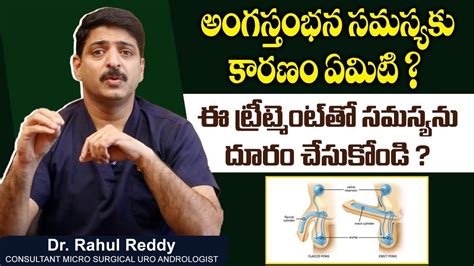 Best Treatment For Erectile Dysfunctions In Telugu Dr Rahul Reddy